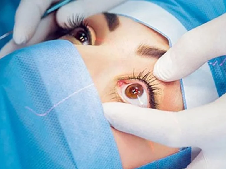 कुदानको थाई मन्दिरमा आज निःशुल्क आँखा शिविर हुने